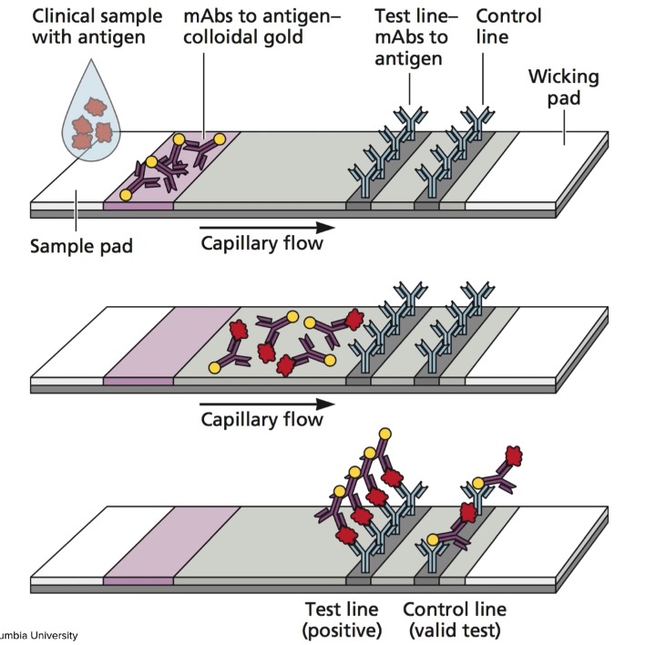 antigen assay