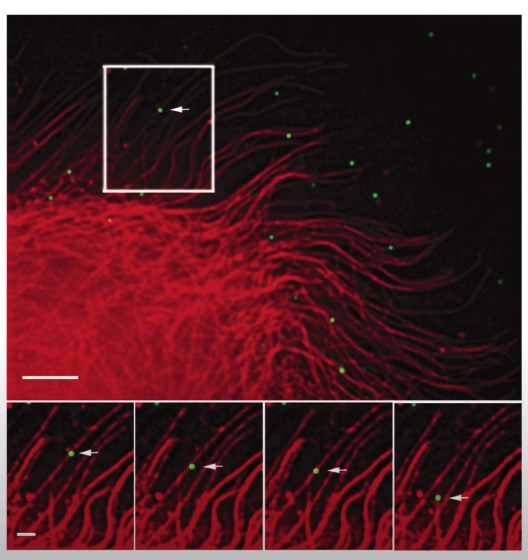 fluorescent protein tracking