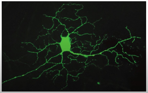 fluorescent particle tracking